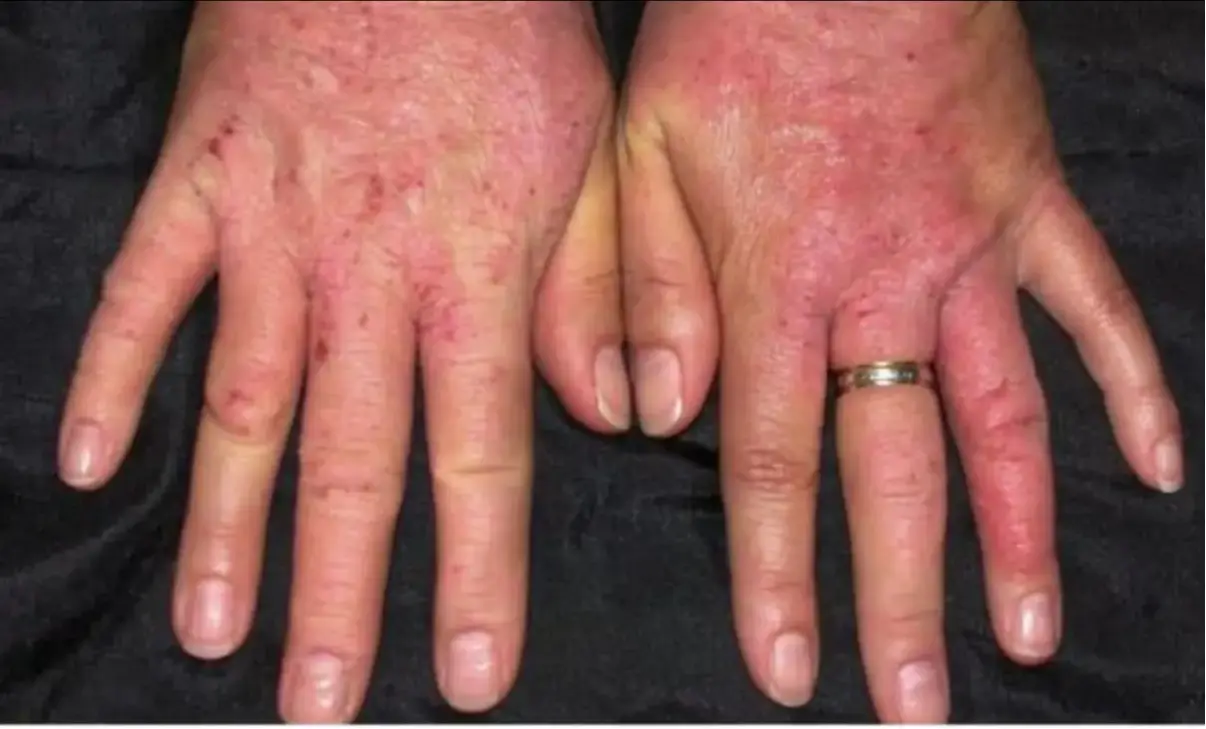 Vital Signs Your Body is Begging for Help