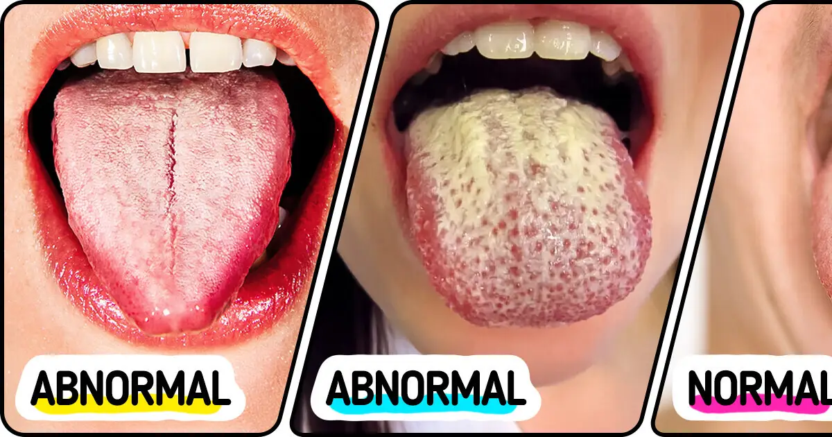 8 Effective Ways to Restore a Healthy, Pink Tongue